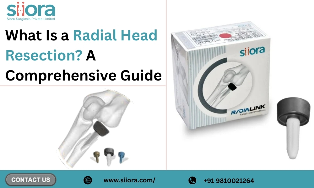 What Is a Radial Head Resection? A Comprehensive&nbsp;Guide.